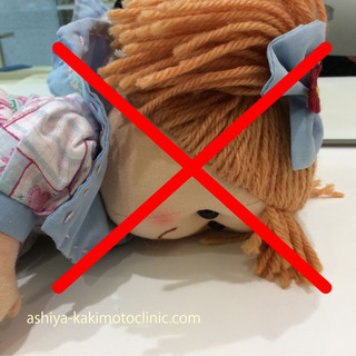うつ伏せ肝斑バツ.jpg