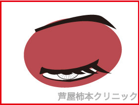 うるしかぶれ.jpg