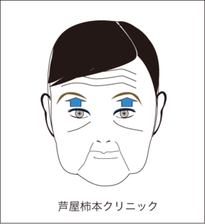 おでこシワ2.gif