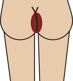 お尻.gif
