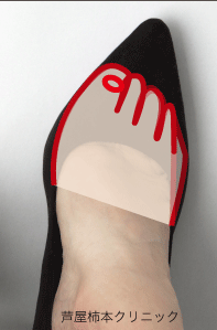 E38197E38282E38284E38191EFBC94-thumbnail2.gif