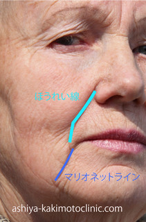 しわ名称.jpg