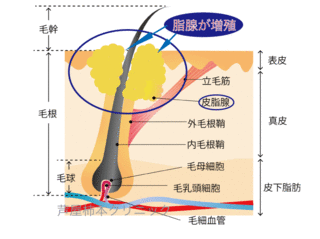 し5.gif