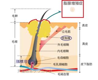 し7.gif