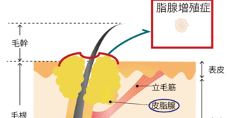 し8.gif