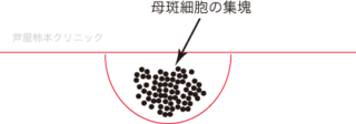 ほくろ大2.gif