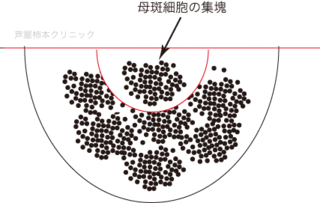 ほくろ大3.gif
