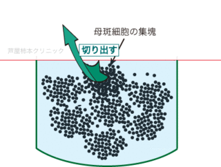 ほくろ大4.gif