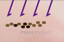 イオン3.gif