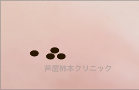 イオン4.gif