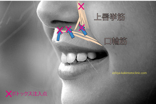 ガミー8.jpg