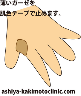 ガーゼ.jpg