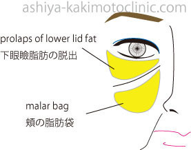 E382B4E383ABE382B4EFBC92-thumbnail2.jpg