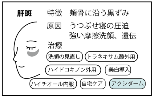 肝斑
