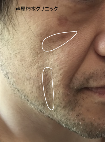 スクリーンショット 2020-08-29 8.39.49.png