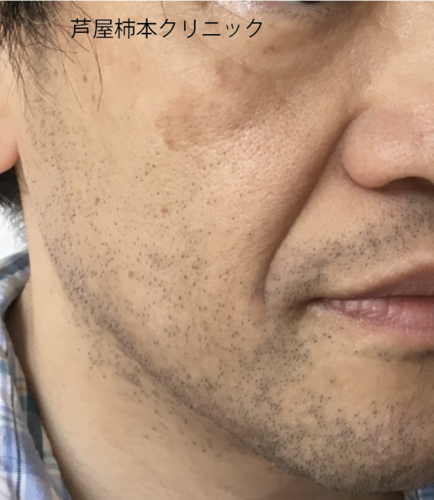 スクリーンショット 2020-08-29 8.43.46.png