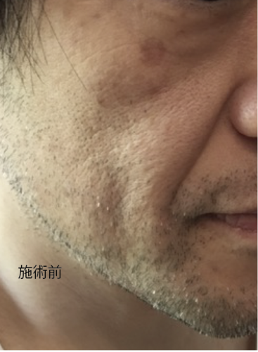 スクリーンショット 2020-08-29 9.19.55.png