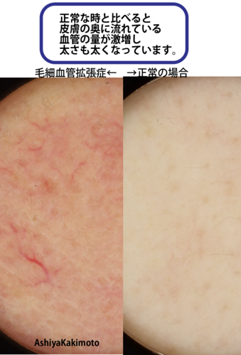 スクリーンショット 2025-05-23 17.21.07.png