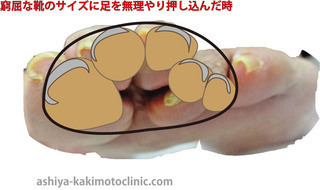 E38391E383B3E38397E382B9E5B1A5E38184E3819FE696ADE99DA2-thumbnail2.jpg