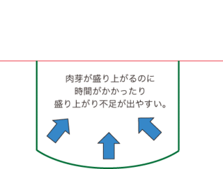 ホクロ6.gif