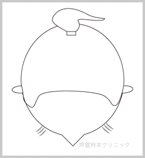 ポニーテール脱毛2.gif