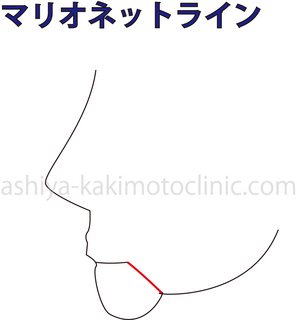 マリオネット1.jpg