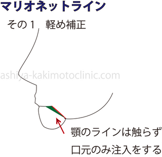 マリオネット4.jpg
