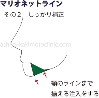 マリオネット5.jpg