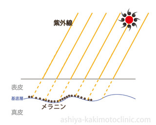 メラニンできる芦屋柿本.jpg