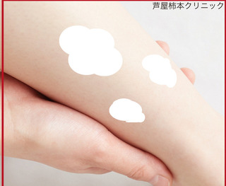 亜鉛華軟膏2.jpg