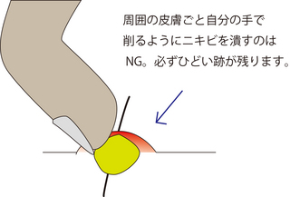 圧出4.jpg