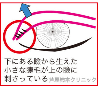 奥二重4.jpg