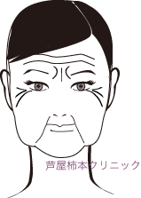定着じわ.gif