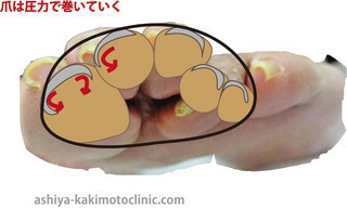 E5B7BBE3818DE788AAE696ADE99DA2-thumbnail2.jpg