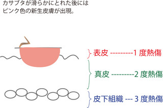 新生皮膚断面.jpg