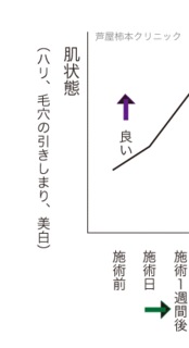 曲線.gif