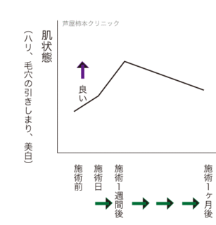 曲線1ヶ月.gif