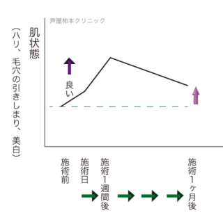 曲線1ヶ月その2.gif