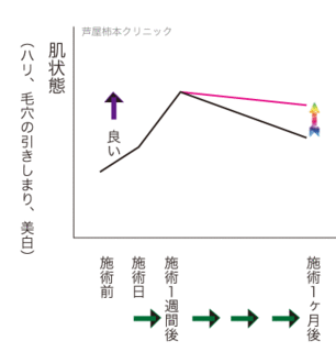 曲線3.gif