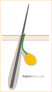 毛穴1.gif