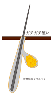 毛穴2.gif