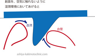 湿潤すると血管は.jpg