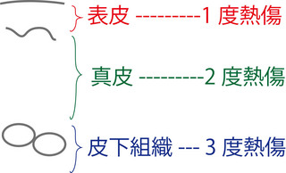 熱傷3層.jpg