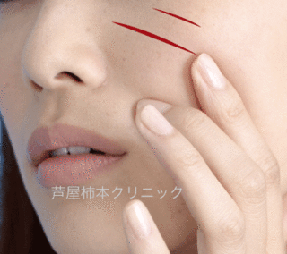 爪痕1.gif