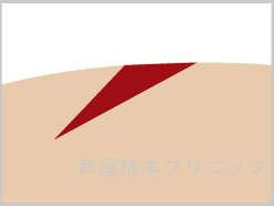 爪痕2.gif