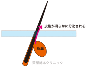 皮脂2.gif
