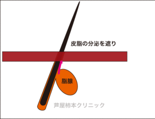 皮脂4.gif