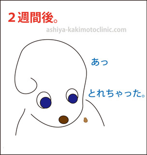 目のイボ7芦屋柿本.jpg