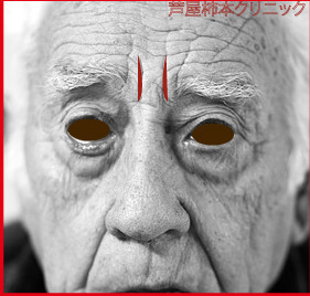 眉間.jpg