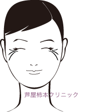 笑い皺.gif
